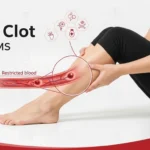 what-does-a-blood-clot-feel-like